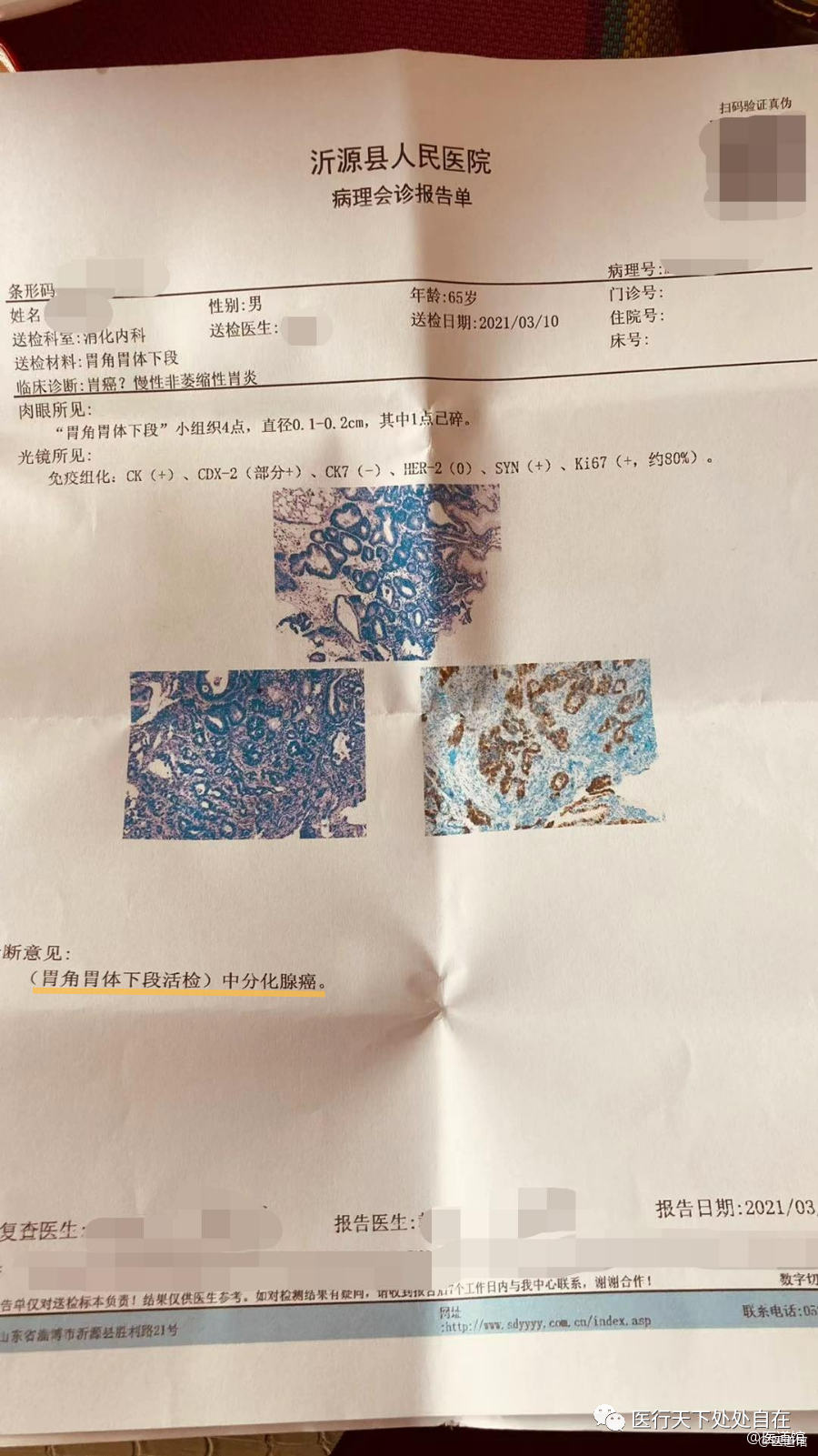 肿瘤癌症篇 | 父亲的胃癌，如何治疗是好？