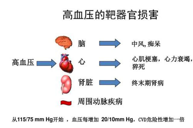 得了高血压若没有症状,就可以忽视了吗?